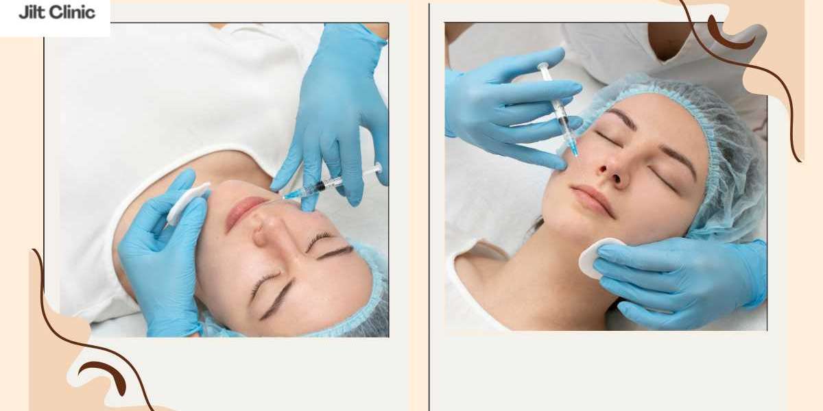 Fett weg Spritze Zürich – Die moderne Lösung für hartnäckige Fettpolster