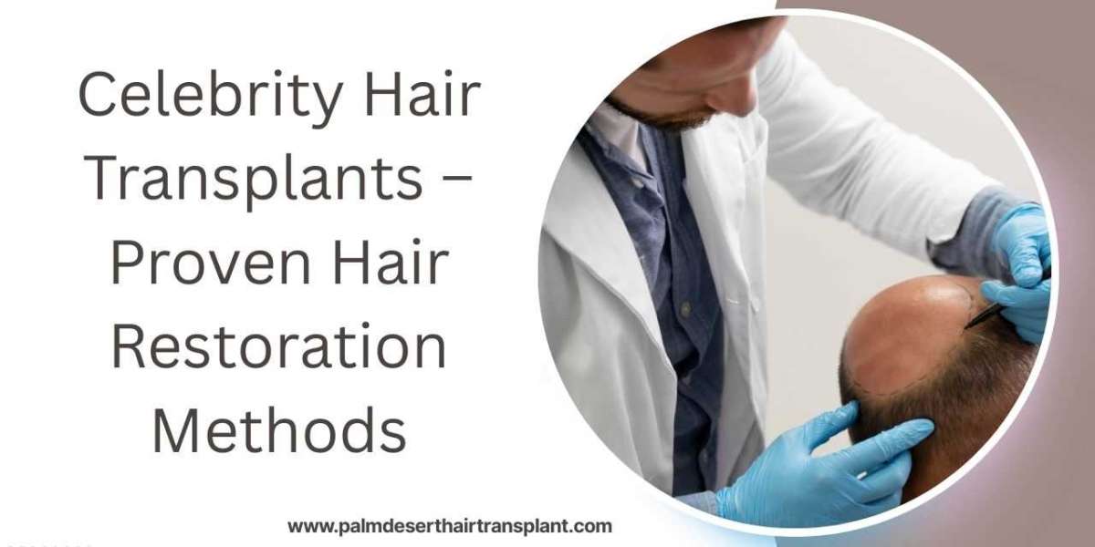 Celebrity Hair Transplants – Proven Hair Restoration Methods